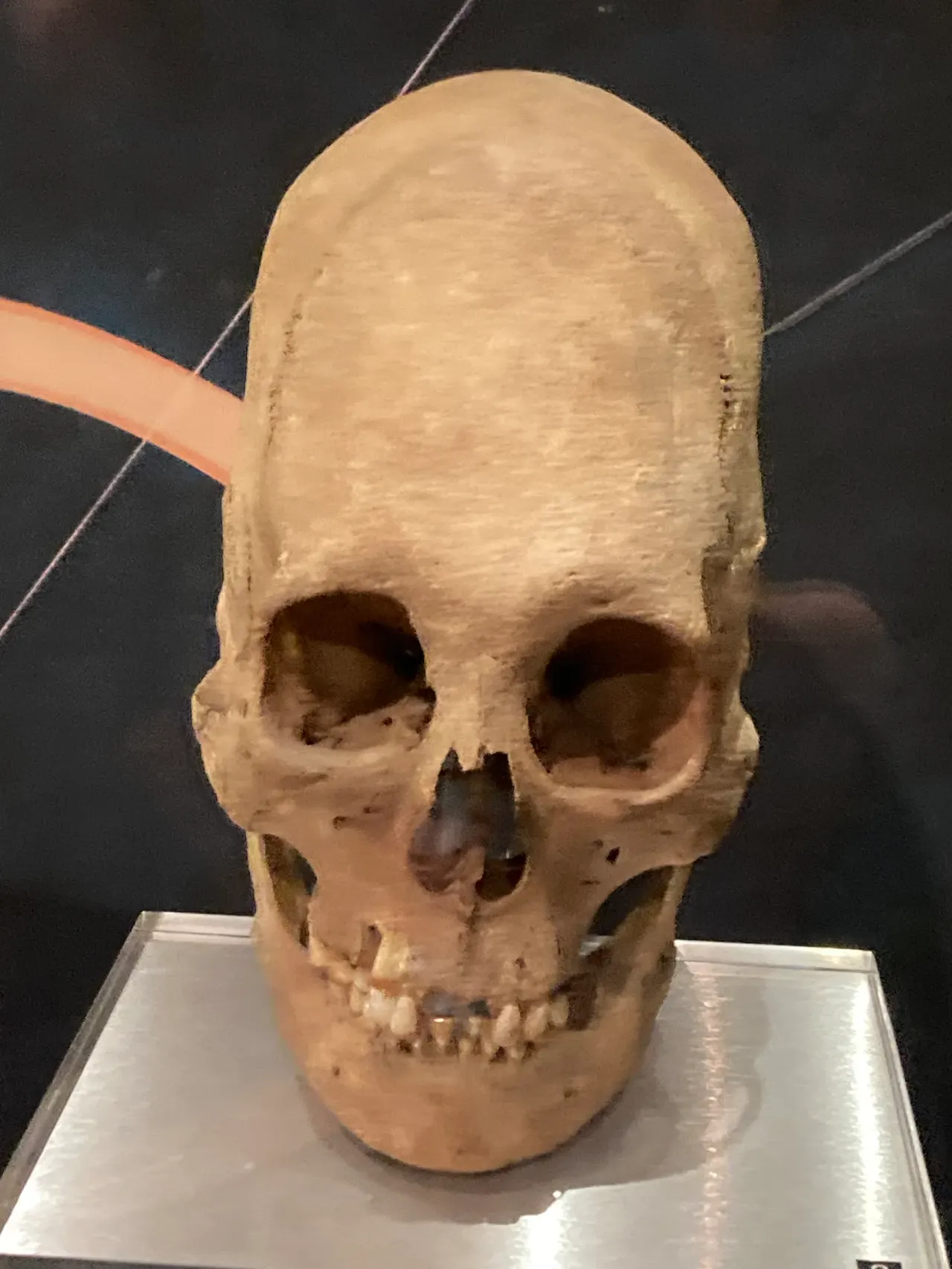 Müze vitrininde, önden görünen bir insan kafatası. Kafatası tepeye doğru belirgin biçimde uzatılmış ve arkaya doğru eğimli; yüz kısmı normal oranlarda.